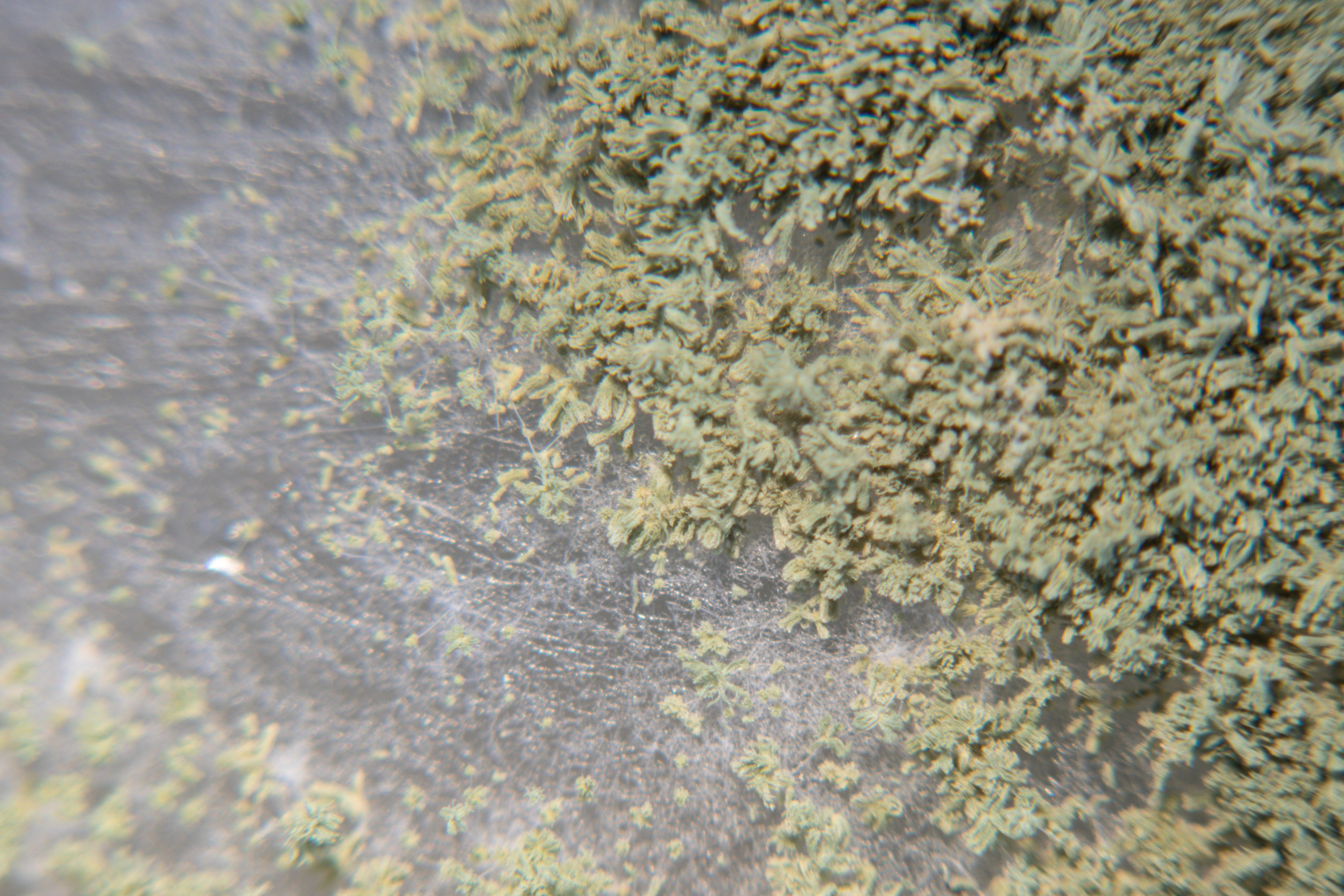 aspergilosis