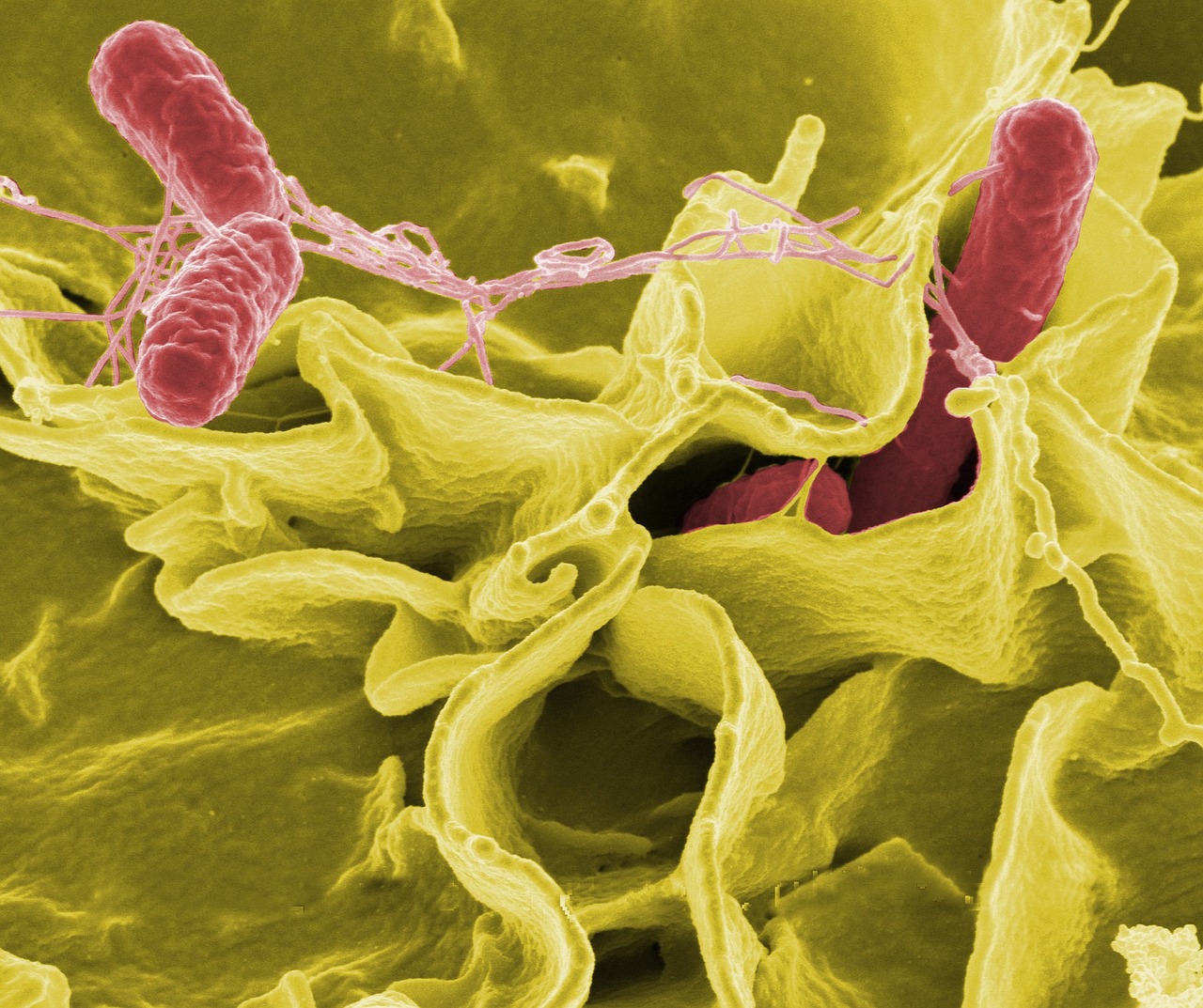 enterobacterias